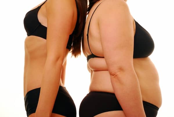 Overweight BMI